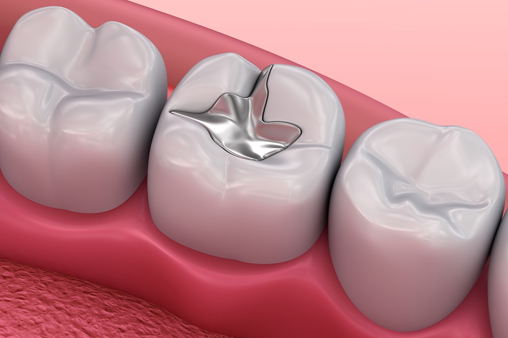 Restorative Dentistry