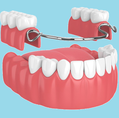 Dentures & Partial Dentures