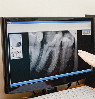 Cutting-Edge Technology for a Healthier Smile
